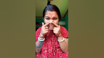 How I Cured a Bug Bite with Yogurt in the Wild | Survival Hacks 😂😨😃