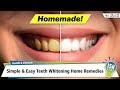 Simple  easy teeth whitening home remedies  ish news