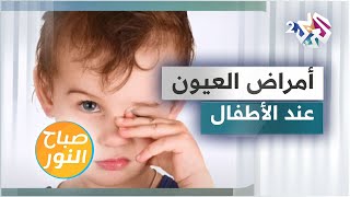 إليكم أبرز أمراض العيون الأكثر شيوعا لدى الرضع مع الاختصاصي علاء الشلبي