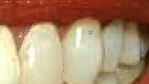 Photoshop Vampire teeth tutorial