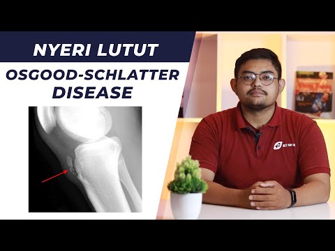 NYERI LUTUT AKIBAT OSGOOD-SCHLATTER DISEASE | Fisioterapi FIRST PHYSIO