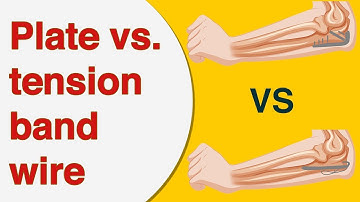 Plate Versus Tension Band Wire Fixation for Olecranon Fractures