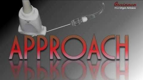 THORACIC PARAVERTEBRAL BLOCK (ANATOMY AND APPROACHES)