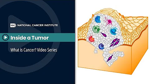 Inside a Tumor: What is Cancer? Video Series - DayDayNews