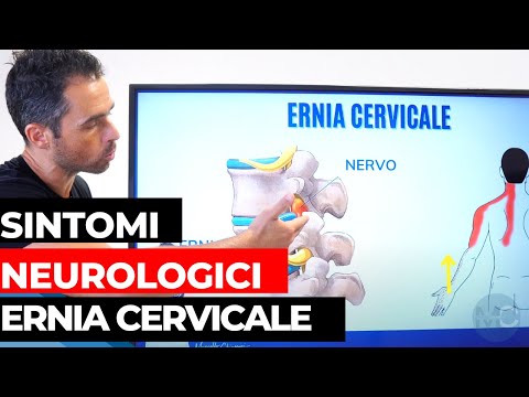 Video: La sezione c può causare ernia?