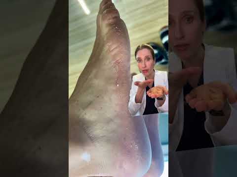 Your feet are