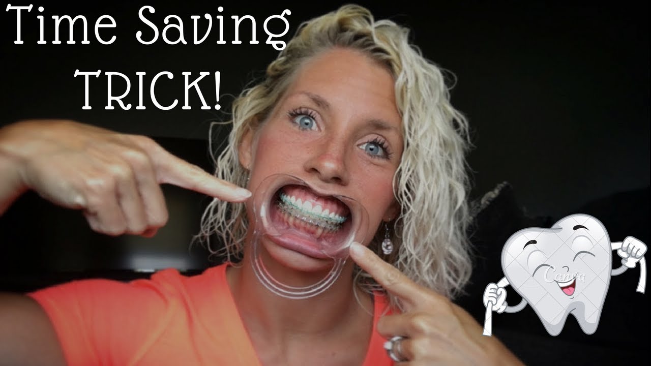 "ADULT BRACES" 16 Months Flossing Trick! YouTube