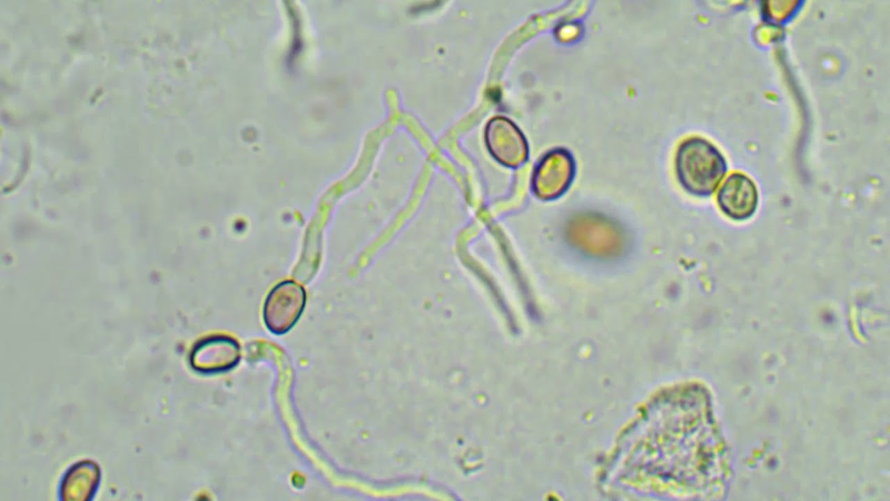 Germinazione spore di Cyclocybe cylindracea , il Pioppino, in timelapse al microscopio ottico