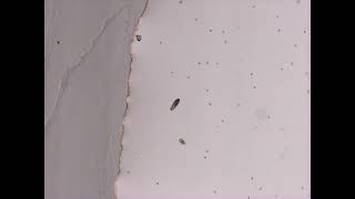 Real-time Paramecium Video Tracking: SimpleXYZ + YOLOv8