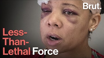 The Human Cost of "Less-Than-Lethal" Force