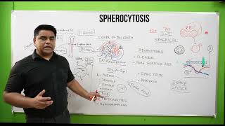 Spherocytosis | Spherocytosis in Hindi | Spherocytosis Pathology | Spherocytosis Sign & Symptoms