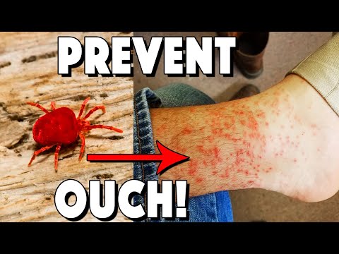 Video: Care este diferența dintre chiggers și bug-uri roșii?