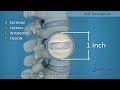 Extreme Lateral Interbody Fusion (XLIF) Procedure Mp3 Song