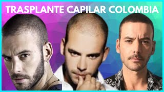 Diego Cadavids Hair Transplant In Colombia With Dr. René Rodríguez