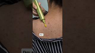 Vitamin C Serum for Glowing Skin ✨ | Brighten &amp; Fade Dark Spots #shorts #brightskin #glowyskin
