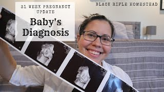 Our Baby Has Ventriculomegaly | 31 week pregnancy update | Baby Boy #3