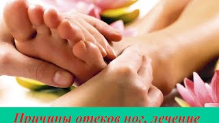Почему отекают ноги - причины и лечение Почему отекают ноги - причины и лечение