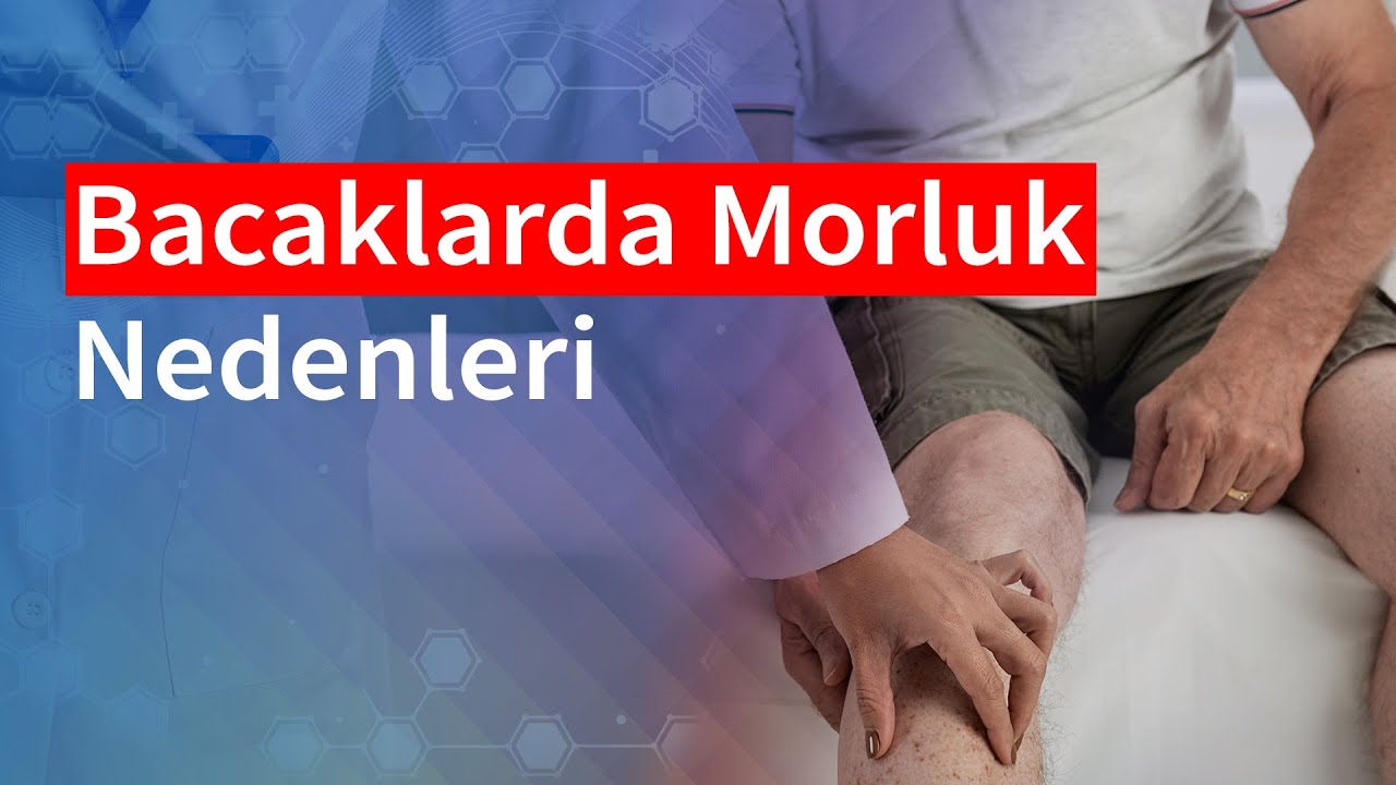 Bacaklarda Morluk Nedenleri | Medical Park
