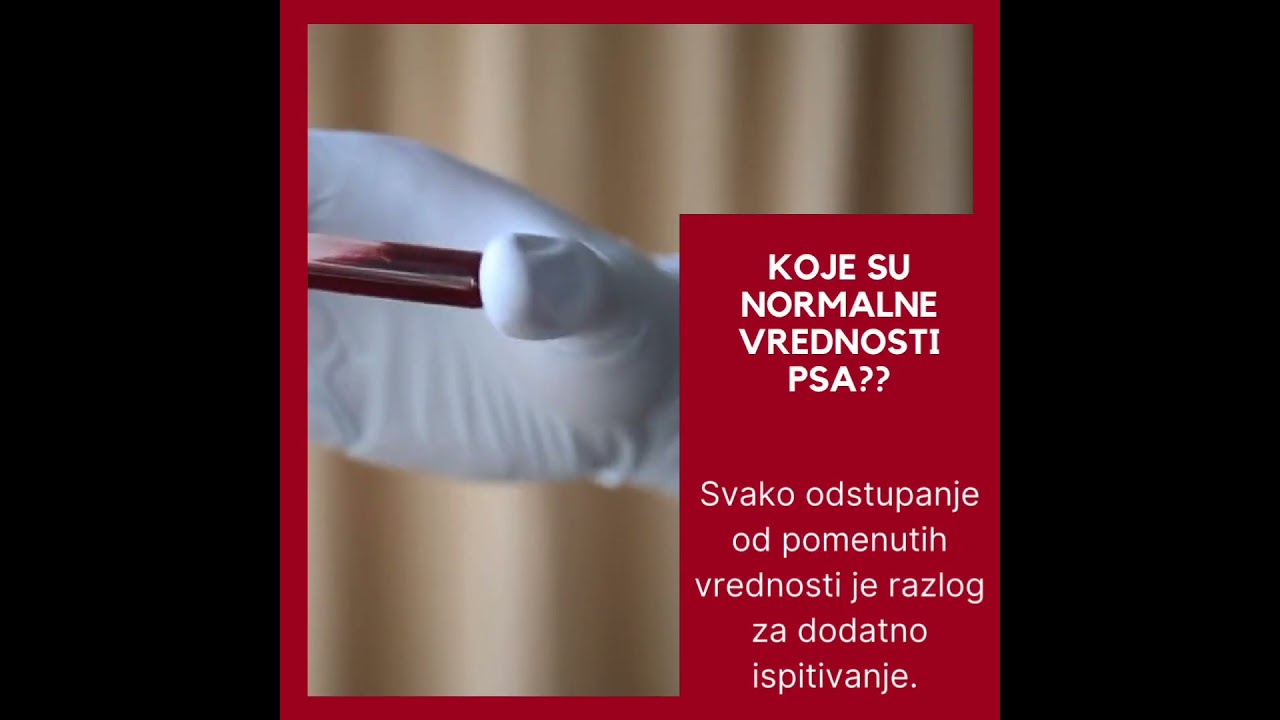 Koje su normalne vrednosti PSA? #urologija #psatest #prostata #urolog