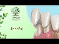 Виниры | Стоматология Краснодара