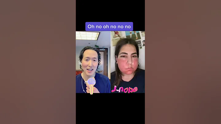 Massive Allergic Reaction?!?! #shorts #allergicreaction