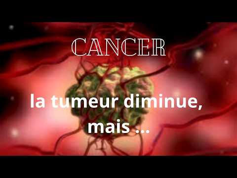 Cancer | Resultat du dernier Scanner