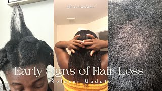 Relaxer Update | Early Warning Signs of HairLoss | CCC Alopecia
