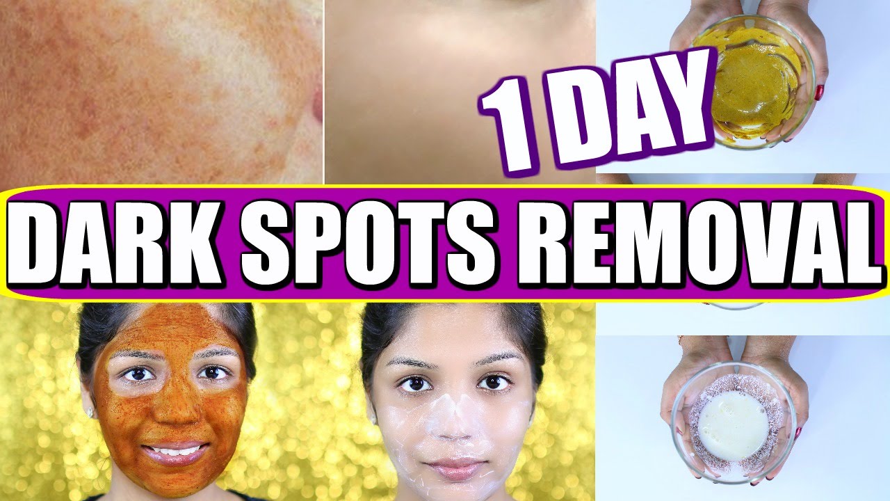 How to remove Dark Spots on Face?