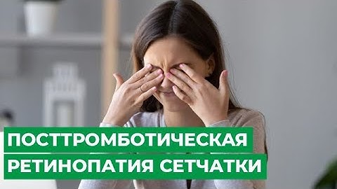 Посттромботическая ретинопатия сетчатки