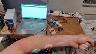 EPQ presentation - Robot Arm Controlled By Electromyography (Muscle Signals) & Exoskeleton