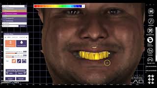 SCANNER FACIAL FROM PLANMECA (PROFACE) IN EXOCAD