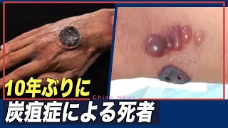 中国 10年ぶりに炭疽症による死者