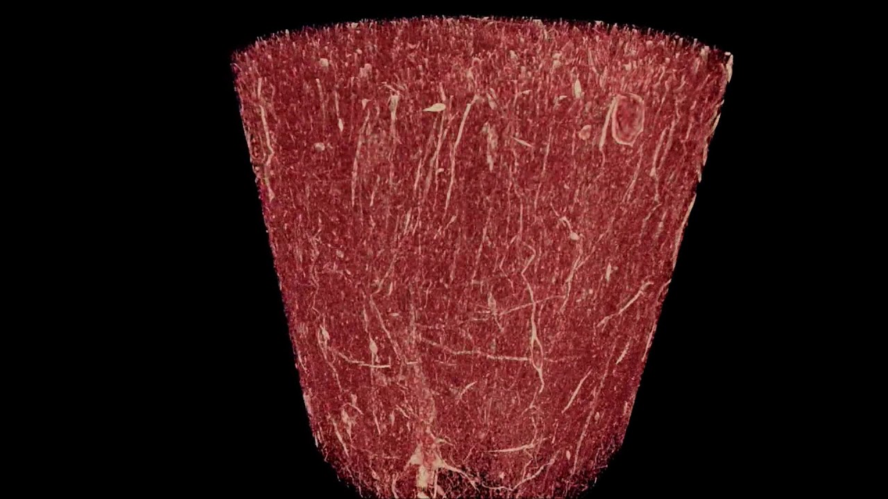 Tendon Fascicle-Inspired Nanofibrous Scaffold of Polylactic acid ...