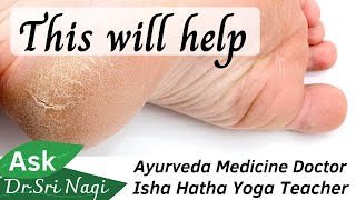 Cracked Heels Home Remedy Ayurvedic Treatment 1 Month course screenshot 5