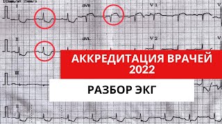 Разбор ЭКГ из АККРЕДИТАЦИИ 2022 года (для кардиологов, терапевтов, функциональных диагностов)Часть 1