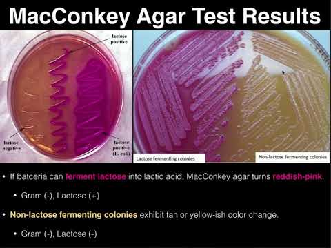 Video: Unterschied Zwischen Blutagar Und MacConkey-Agar