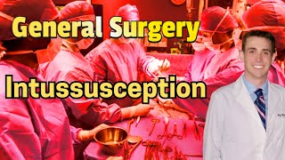 Intussusception (updated 2024) - CRASH! Medical Review Series Intussusception (updated 2024) - CRASH! Medical Review Series