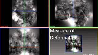 AUG Signals' Automatic Tumour Detection and Recognition Software screenshot 5