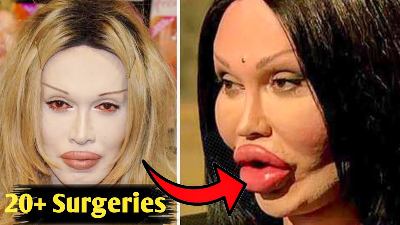 People Who Destroyed Their Faces With Cosmetic Surgeries - YouTube