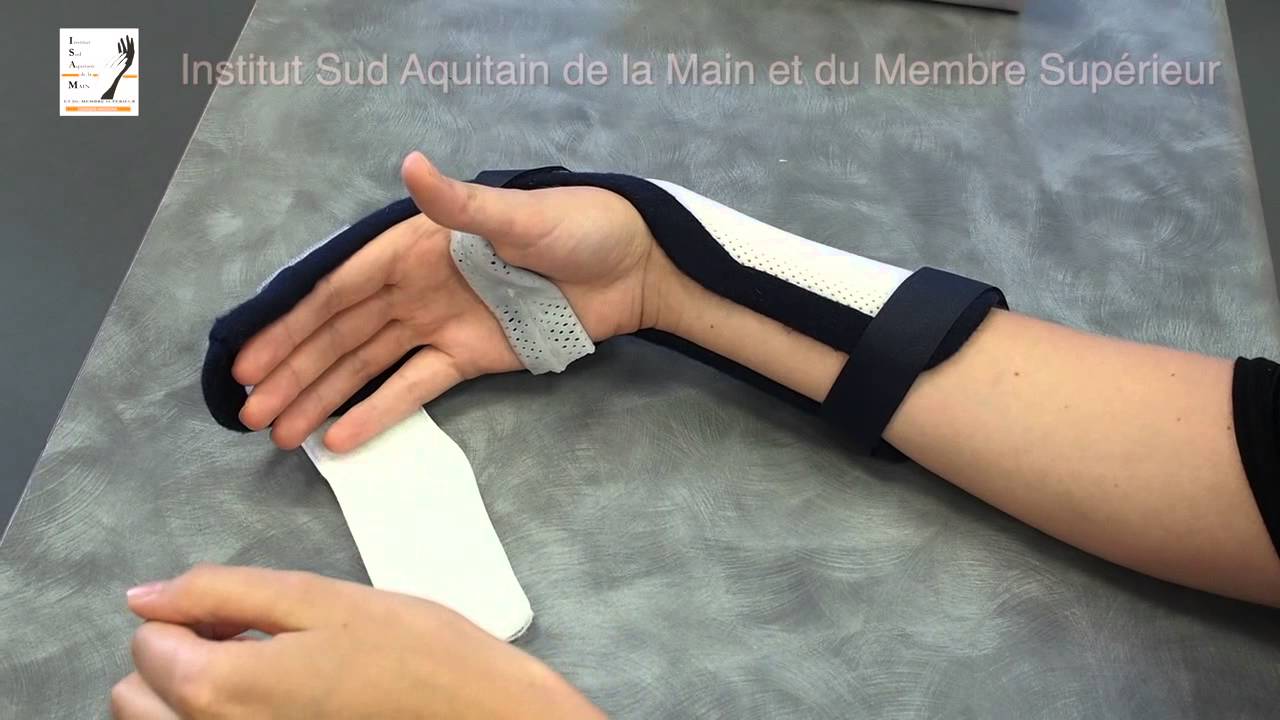 Conseils aux patients après section des tendons fléchisseurs