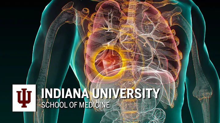 Catching Cancer Early