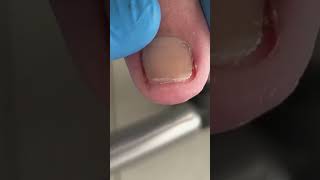 Satisfying pedicure video! #pedicure #toenails