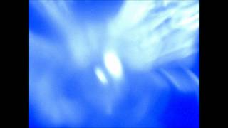 Lovesickness (music)