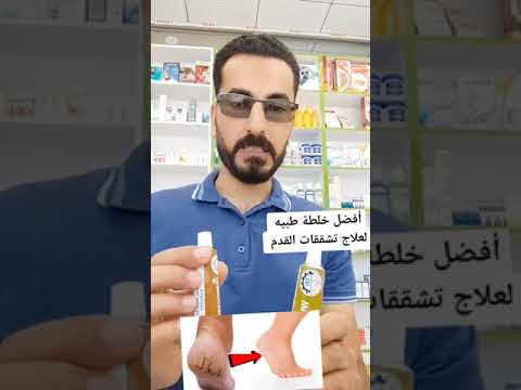 أفضل وصفه من الصيدليه لعلاج تشققات القدم