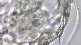 Collapsing Blastocyst prior to Cryofreezing with Vitrification