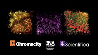 Webinar: Multiphoton imaging using next generation indicators