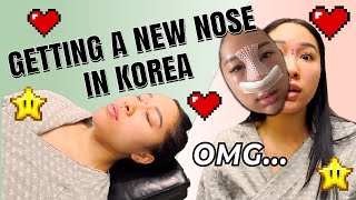 I GOT A NEW NOSE IN KOREA... (my experience)