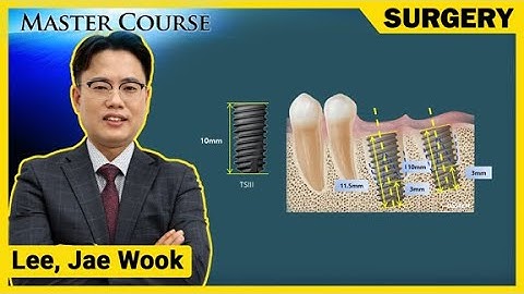 [Master Course Season2 - SURGERY] Immediate placement in the posterior region