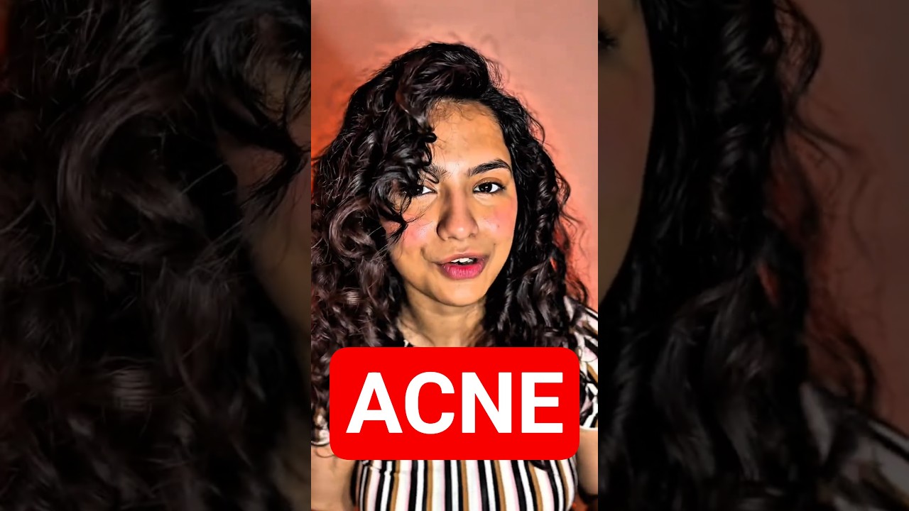 Acne Affecting Your Confidence? | Lifestyle Blogger Hira Azhar | Gut Harmony