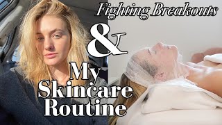 Winter Model Skincare Routine | How I Prevent Breakouts + Treatments For Clear Skin | Sanne Vloet